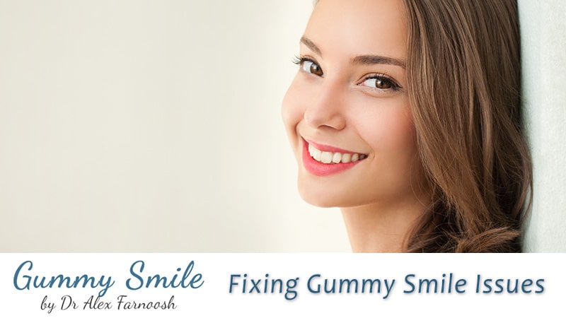 Fixing Gummy Smile Issues