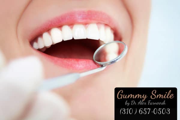 Why You Want Bleach Gums in Los Angeles