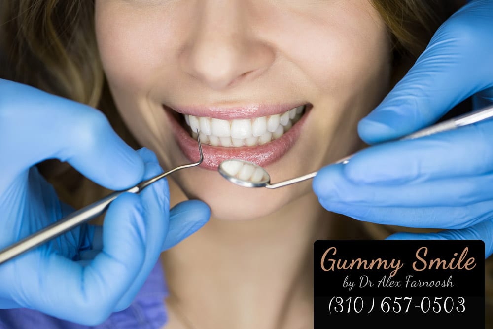 Researching Dark Gums Treatment in Los Angeles