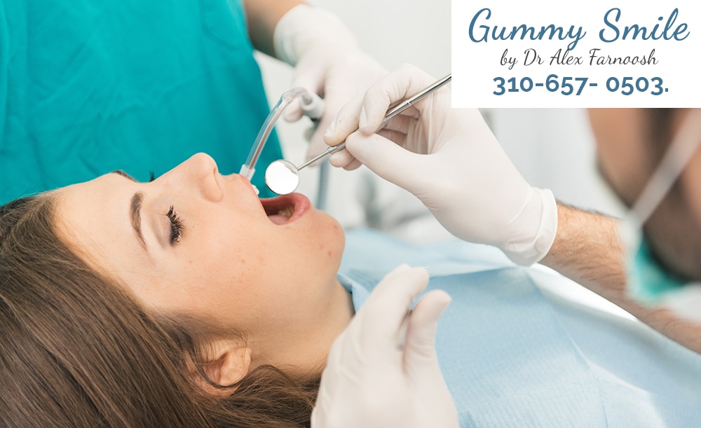 The Best Treatment for Dark Gums in Los Angeles
