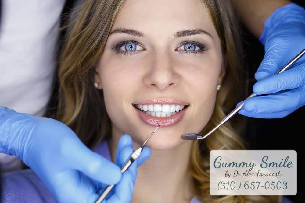 The Process of Gum Whitening in Los Angeles
